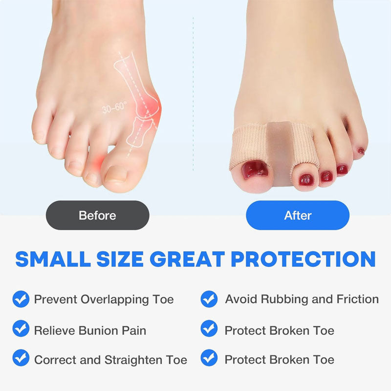 FlexiStep – Hallux Valgus – Großzehenkorrektur | 1+1 GRATIS