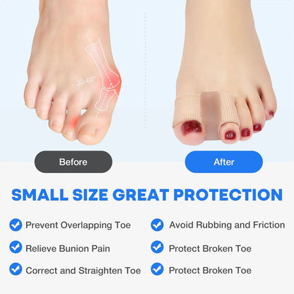 FlexiStep – Hallux Valgus – Großzehenkorrektur | 1+1 GRATIS